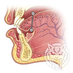 Anatomie des Zungenpiercing - Schematisch
